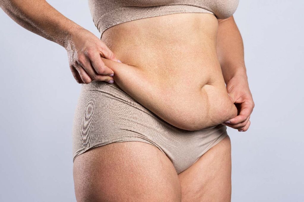 Body Contouring After Weight Loss