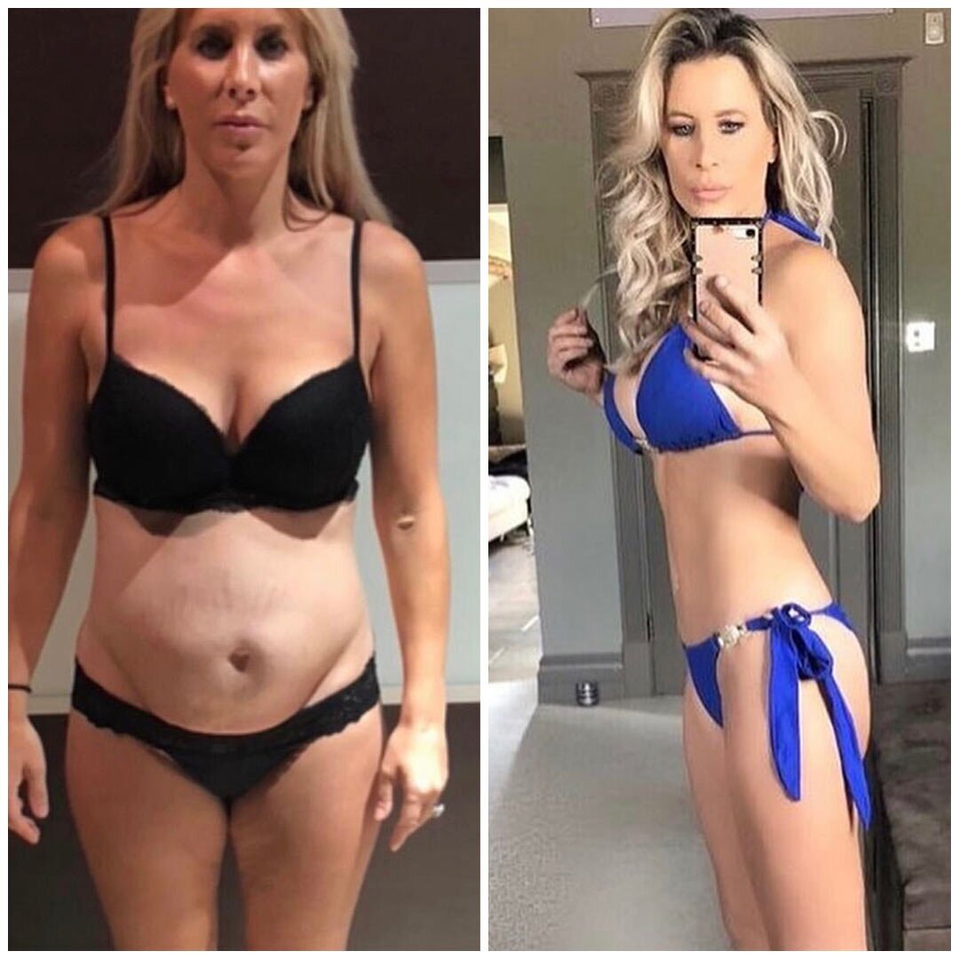 Celebrity plastic surgeon Reza Nassab performed a mummy makeover on the Real Housewives of Cheshire star Rachel Lugo