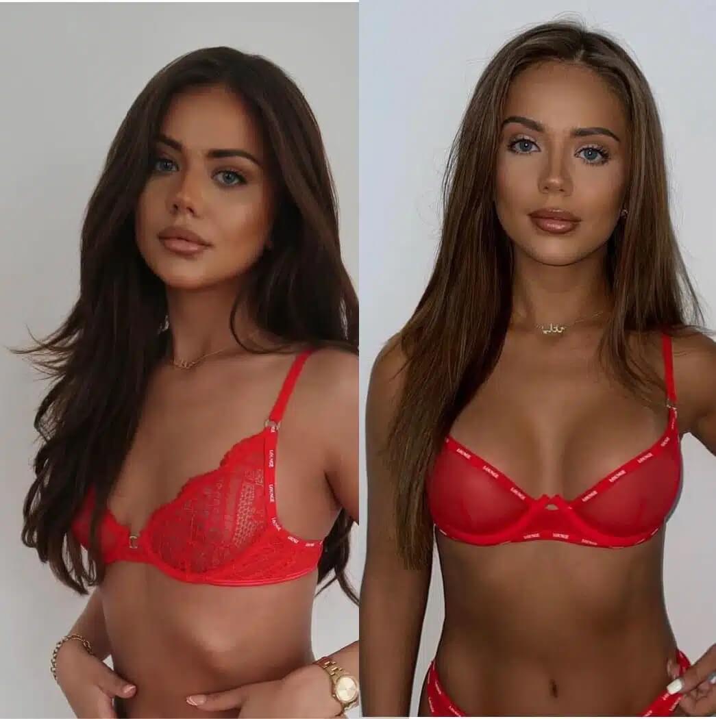 Celebrity plastic surgeon Reza Nassab performed a breast augmentation on Love Island star Natalia Zoppa