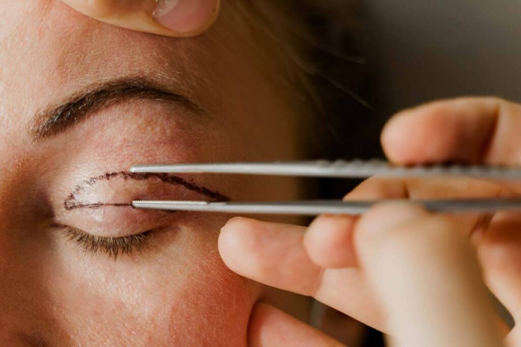 Hooded Eyes: What Causes Them and How to Fix Them