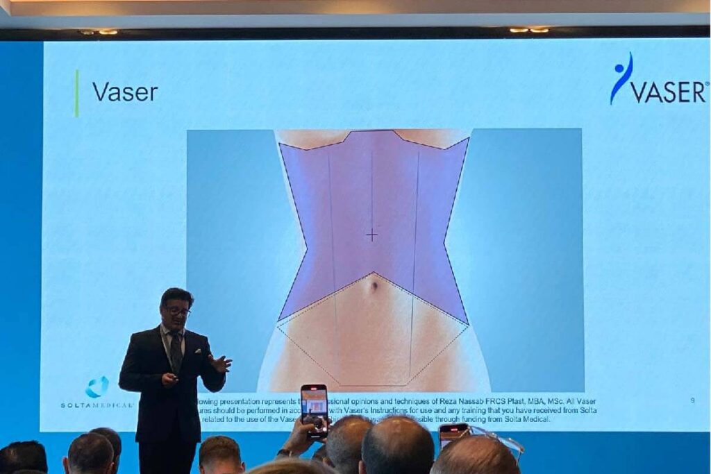 Mr Reza Nassab Speaks at Vaser Meet the Experts Meeting 2025