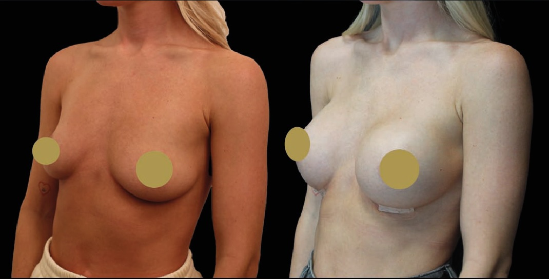 Motiva Preserve before and after