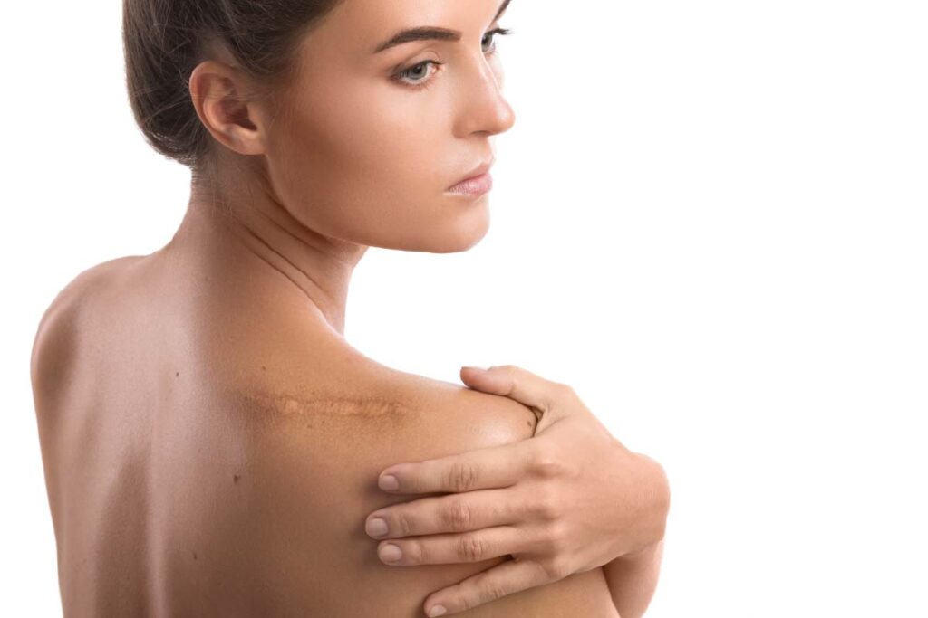 Silicone Scar Tape and Gel for Cosmetic Surgery Scars